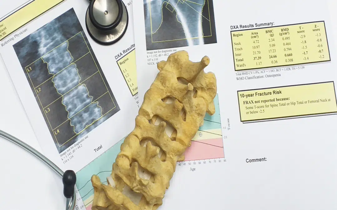 Peak bone mass image 2