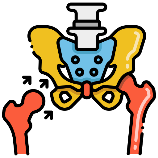 Hip replacement