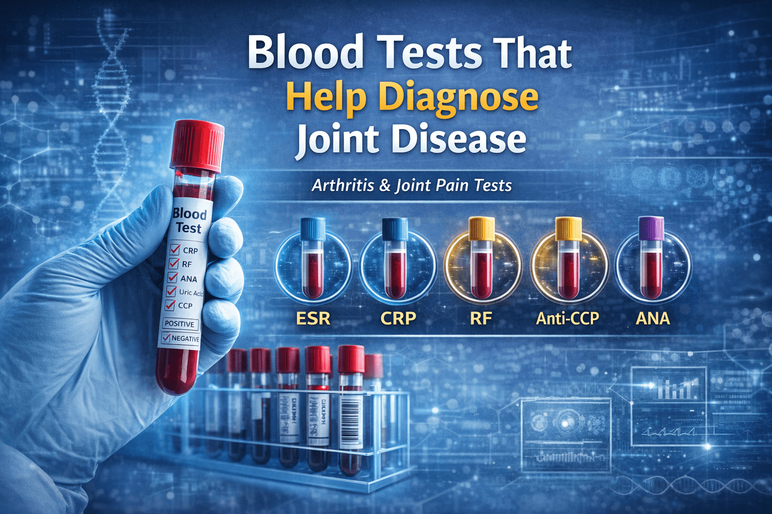 Blood Tests That Help Diagnose Joint Disease | Arthritis & Joint Pain Tests